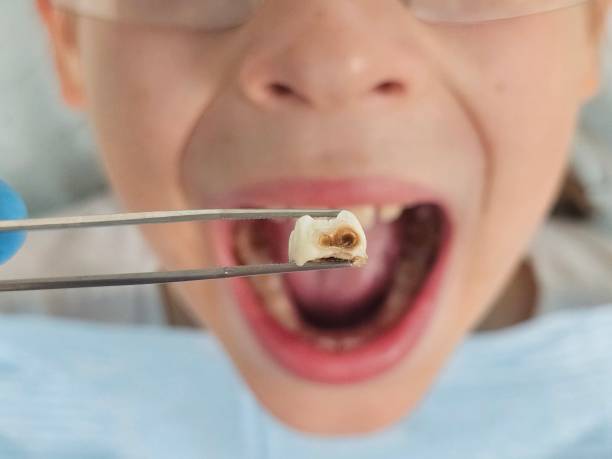 Best Emergency Dentist for Special Needs Patients in Sharon, MS